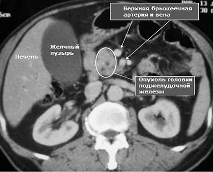 Felkészülés hasi MRI funkciók, amelyek kell figyelni