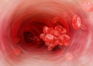 Thrombosis - tünetek és okoz vérrögök, kezelést és a betegségek megelőzésére