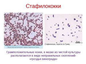 Típusai és tünetei staphylococcus diagnózis és kezelési módszerek, valamint azt, hogy milyen veszélyes lehet, és hogyan