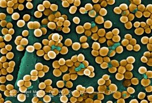 Mi magyarázza, hogyan lehet átvinni a bakteriális staphylococcus - egészséges