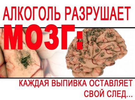A hatás a társadalom véleményének egy személy (alkohol emberi test) A hatás a társadalom véleményének egy személy