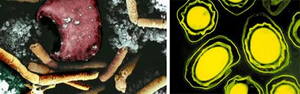 Baktériumok cpory és sporulációja