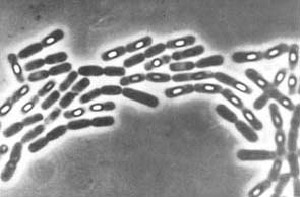 Baktériumok cpory és sporulációja