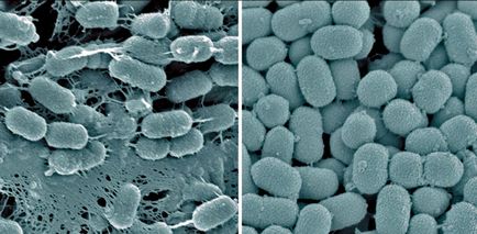 Baktériumok és mikrobák a mikroszkóp alatt