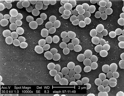 Baktériumok és mikrobák a mikroszkóp alatt