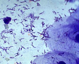 Baktériumok és mikrobák a mikroszkóp alatt (fotók)