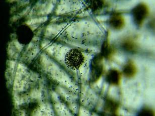 Baktériumok és mikrobák a mikroszkóp alatt (fotók)