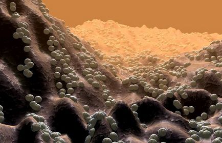 Baktériumok a mikroszkóp alatt (13 fotó)
