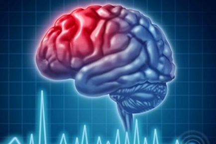 agyi ischaemia, mi ez, tünetek és kezelés hatásának mértékét, mennyi az élő
