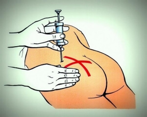 Hogyan készítsünk egy lövés a farba, intramuszkuláris injekciók otthon, a technológia