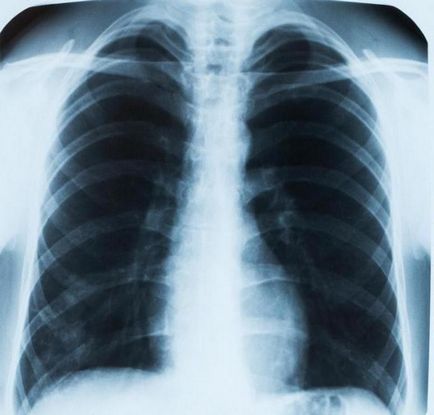 Hogyan lehet ellenőrizni a könnyű módszerek tüdő vizsgálata