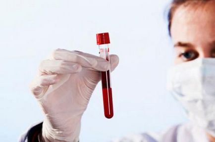 Hogyan megölni HIV-hőmérsékleti mutatók kedvezőtlenül befolyásolhatja a retrovírus