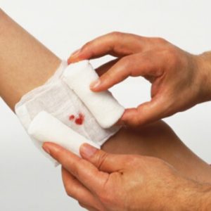 otthoni kezelés a nyílt sebek, mint kezelni egy nyílt seb, a szakaszok sebgyógyulás kenőcs