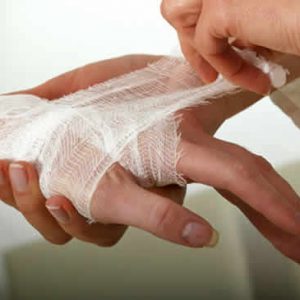 otthoni kezelés a nyílt sebek, mint kezelni egy nyílt seb, a szakaszok sebgyógyulás kenőcs