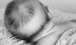 Kopasz folt a háton és a fej a csecsemők okoz, kezelés, tanácsadás