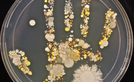 Baktériumok a mikroszkóp alatt, a baktériumok a kezét (fotó)