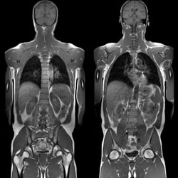 Teljes test MRI - és árfeltüntetések diagnosztizálására magatartási