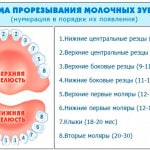 Kitörés a felső fogak gyermekeknél fotók, tünetek