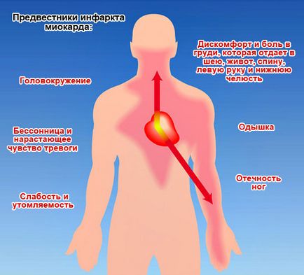 Egy szívroham okoz, tünetei, kezelése és mit kell tenni