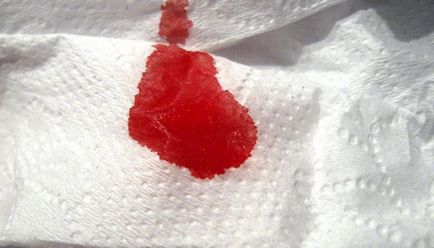 Mennyi vért egy nő elveszíti a menstruáció alatt, és hol vannak az áramlás a menstruáció