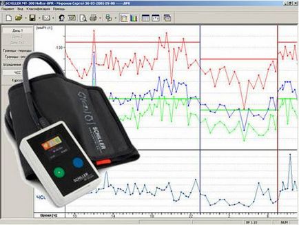 Ambuláns vérnyomásmérő (ABPM) és a szívfrekvencia
