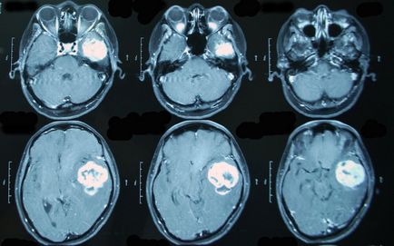 Imaging az egész test