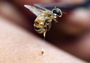 Méh csípés, hogy mit lehet csinálni otthon, és hogyan kell adni elsősegély