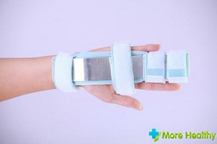 Mi a teendő, ha az ujja hegyét elsősegély kéznél, kezelése (kiütötte) Mi a teendő, ha kopogtatott az ujját a kezét elsősegélynyújtás
