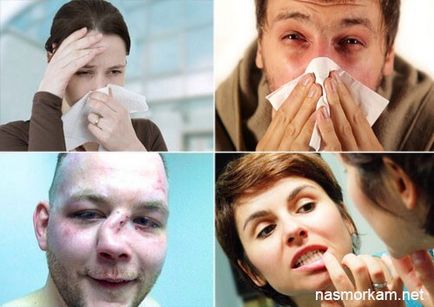 A ciszta az orr (orrmelléküregek) tünetek, kezelés, következményei (ciszta) A ciszta az orr (orrmelléküregek) tünetek, kezelés, következményei