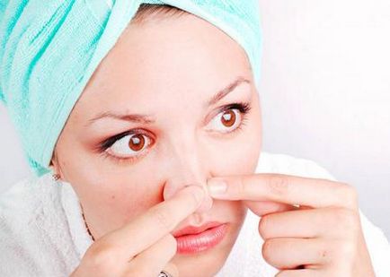 Hogyan lehet megszabadulni a mitesszerek az orrát (távolítsa el őket gyorsan, tiszta bőr)