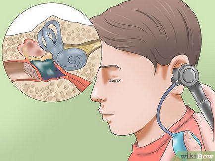 Hogyan kell kezelni egy fülfertőzés