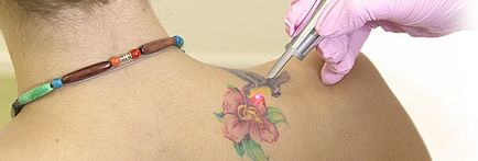 Hogyan készítsünk egy tetoválás otthon vagy lézer