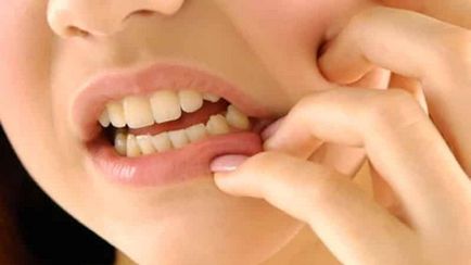 Hogyan lehet gyógyítani a fogat otthon