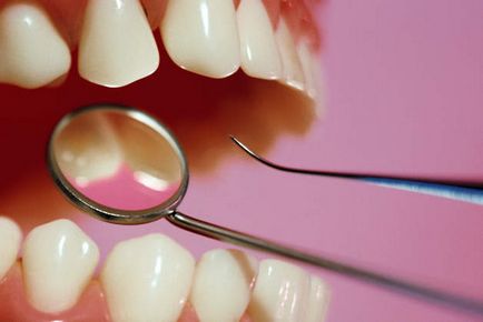 A periodontitis élvezet otthon népi jogorvoslati