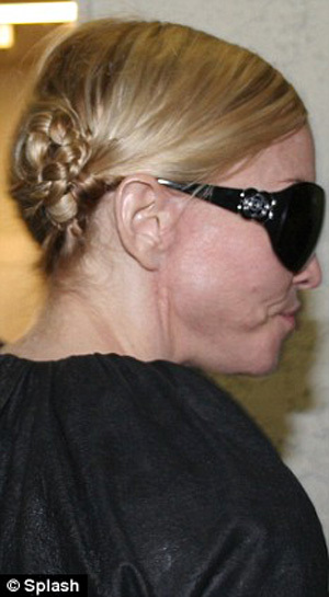Szakértők becslése plasztikai sebészet Madonna toyboy88 blogger a helyszínen június 24, 2011,