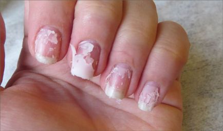 Helyreállítás a köröm építeni recepteket és tippeket (köröm) Recovery Nails felépítése után recepteket és tippeket