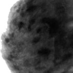 Glandular mell - rostos és cisztás (emlő) Glandular mell - rostos és cisztás