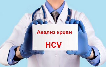 HCV vérvizsgálat, mi ez