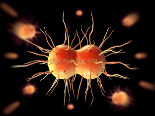 Mi a gonorrhea betegség