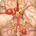 agy encephalopathia kezelésére