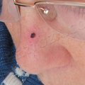 Vélemények az allergia, mint a Vélemények az allergia, mint a