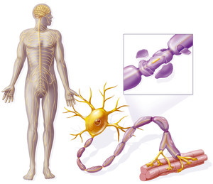 Hírek a sclerosis multiplex