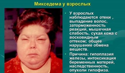 Mi hiányos szív-blokk Mi hiányos szív-blokk