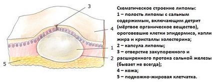 Hogy nyomjuk wen