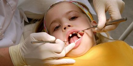 periodontitis kezelésére gyermekeknél periodontitis kezelésére gyermekeknél