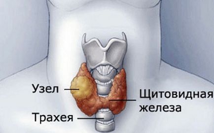 Pajzsmirigy volumen gyermekeknél