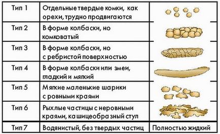 Mi a teendő, ha a székrekedés Mi a teendő, ha a székrekedés