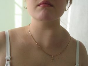Antibiotikumok a duzzadt nyirokcsomók a nyakon, ágyék felülvizsgálat (gyulladás) Antibiotikumok a duzzadt nyirokcsomók a nyakon, ágyék felülvizsgálat