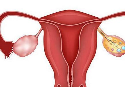 Fájó (húzás) petefészek okai, tünetei, diagnózisa, kezelése (húzza húzza petefészek petefészek petefészek fájós jobb menstruáció előtt) Hurts (húzás) a petefészek okok, tünetek, diagnózis, kezelés