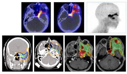 Mi a különbség egy MRI CT eseteket, amelyekben MRI jobb, mint a CT